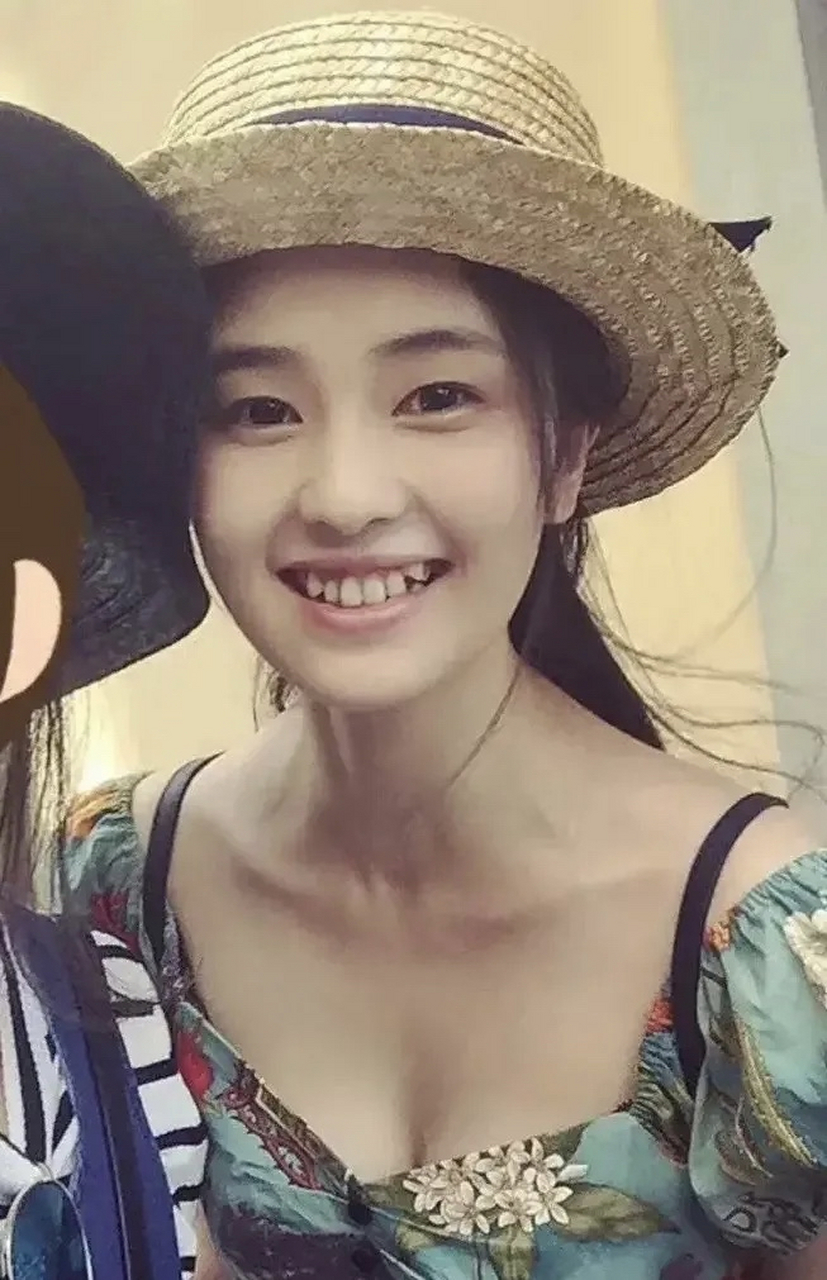 白鹿整牙是正确的选择,牙齿矫正后变漂亮很多.