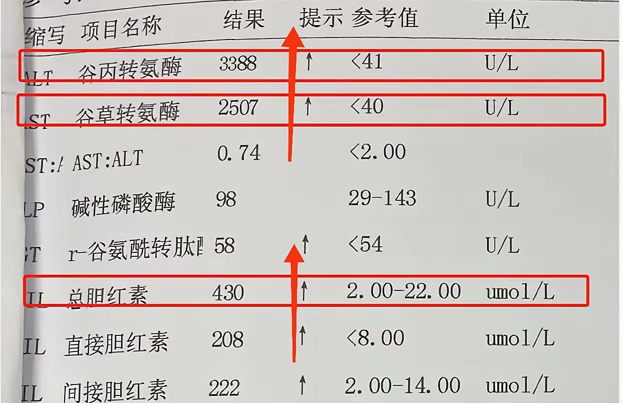 1,转氨酶:转氨酶是反映肝脏出现损伤的灵敏指标,当肝细胞出现损伤