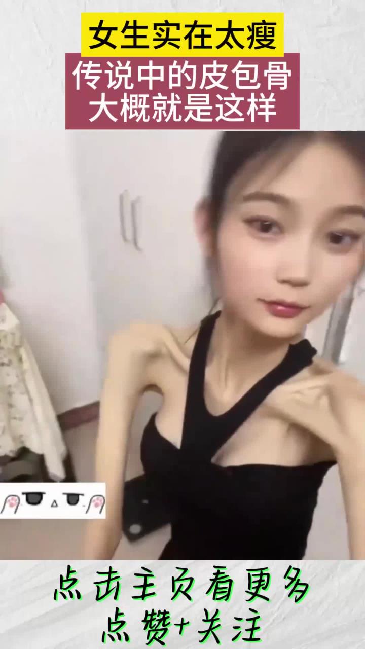 女生实在太瘦,传说中的皮包骨,大概就是这样