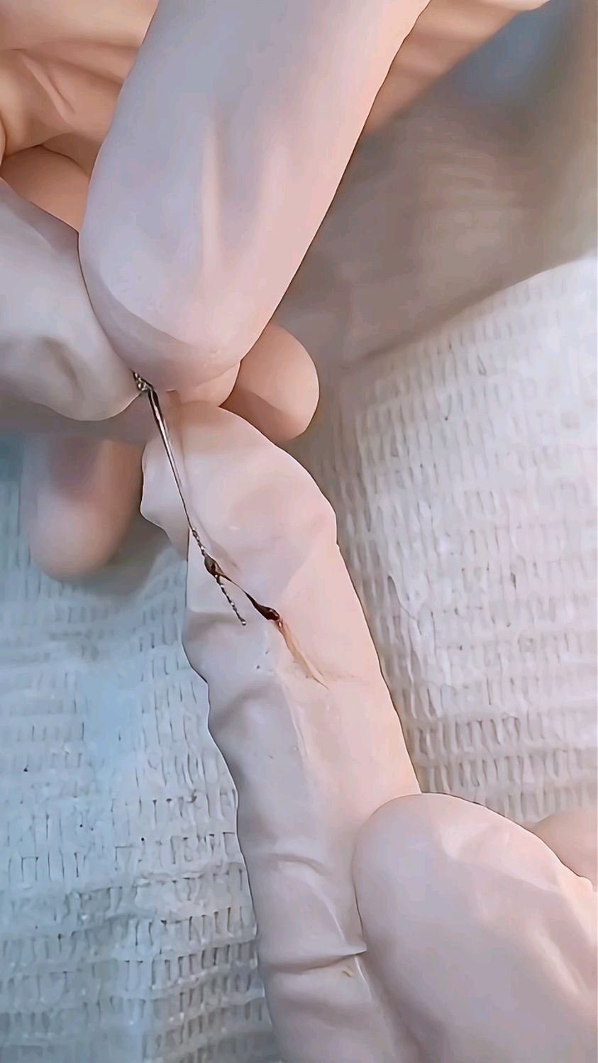 坏死的牙神经,不劲道,有味道!