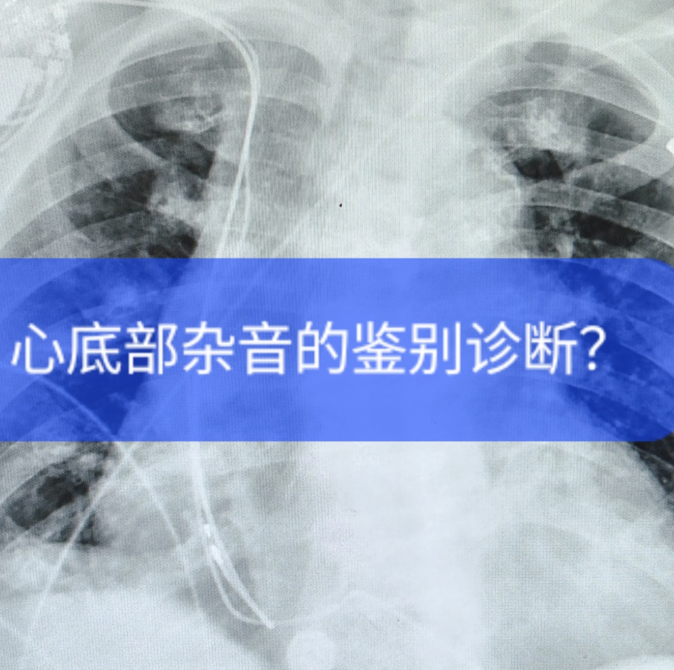 心底部杂音的鉴别诊断?