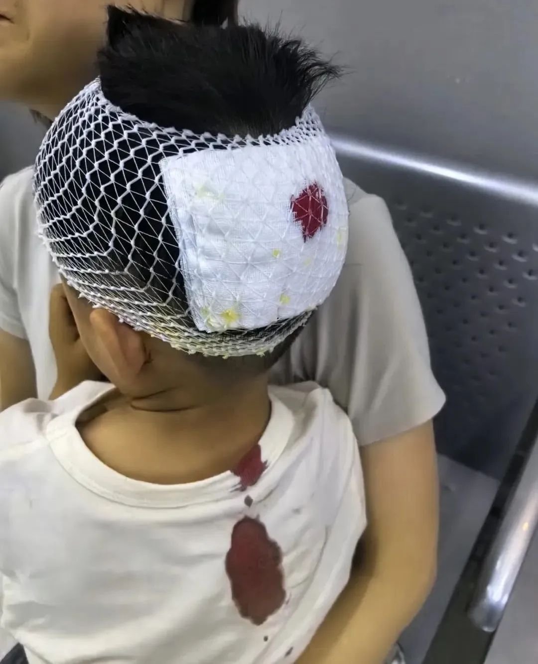 顺义一孩子摔伤血流一地 关键时刻这个身影暖人心