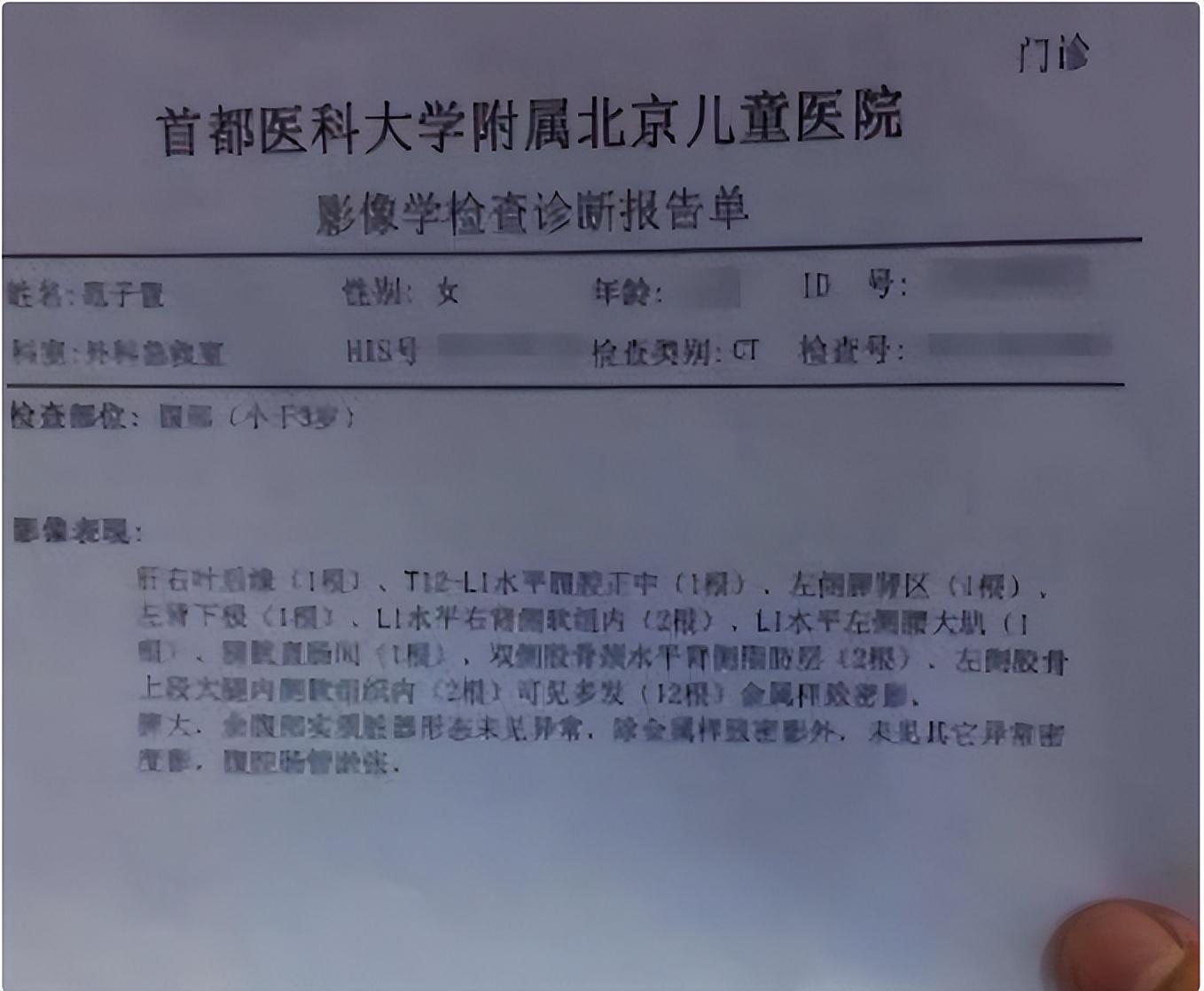 北京儿童医院CT加急-北京儿童医院急诊可以照ct吗 