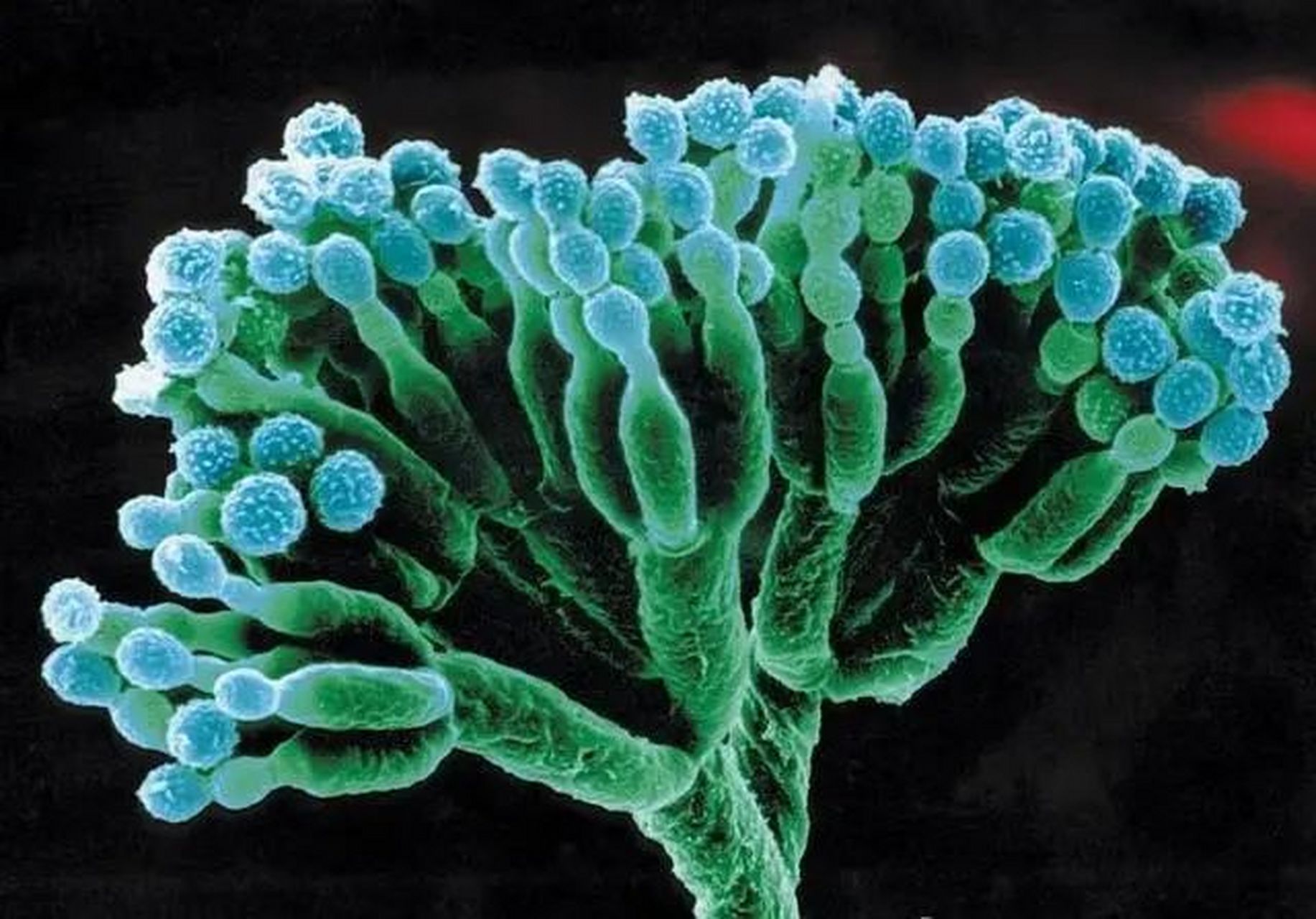 电子显微镜下的丝状细菌和伞状细菌