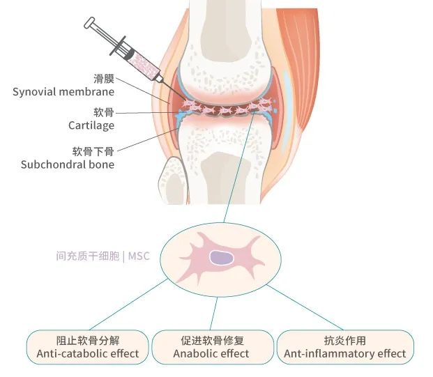 早安心|河南郑州的膝友有福啦,干细胞靶向注射膝关节/关节腔来了