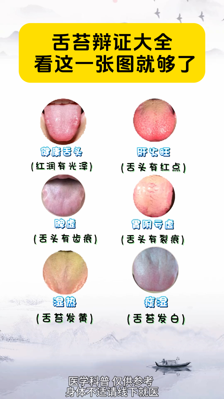 舌苔辩证大全,一张图就够了#中医##舌诊##健康##舌象##养生##中医舌诊