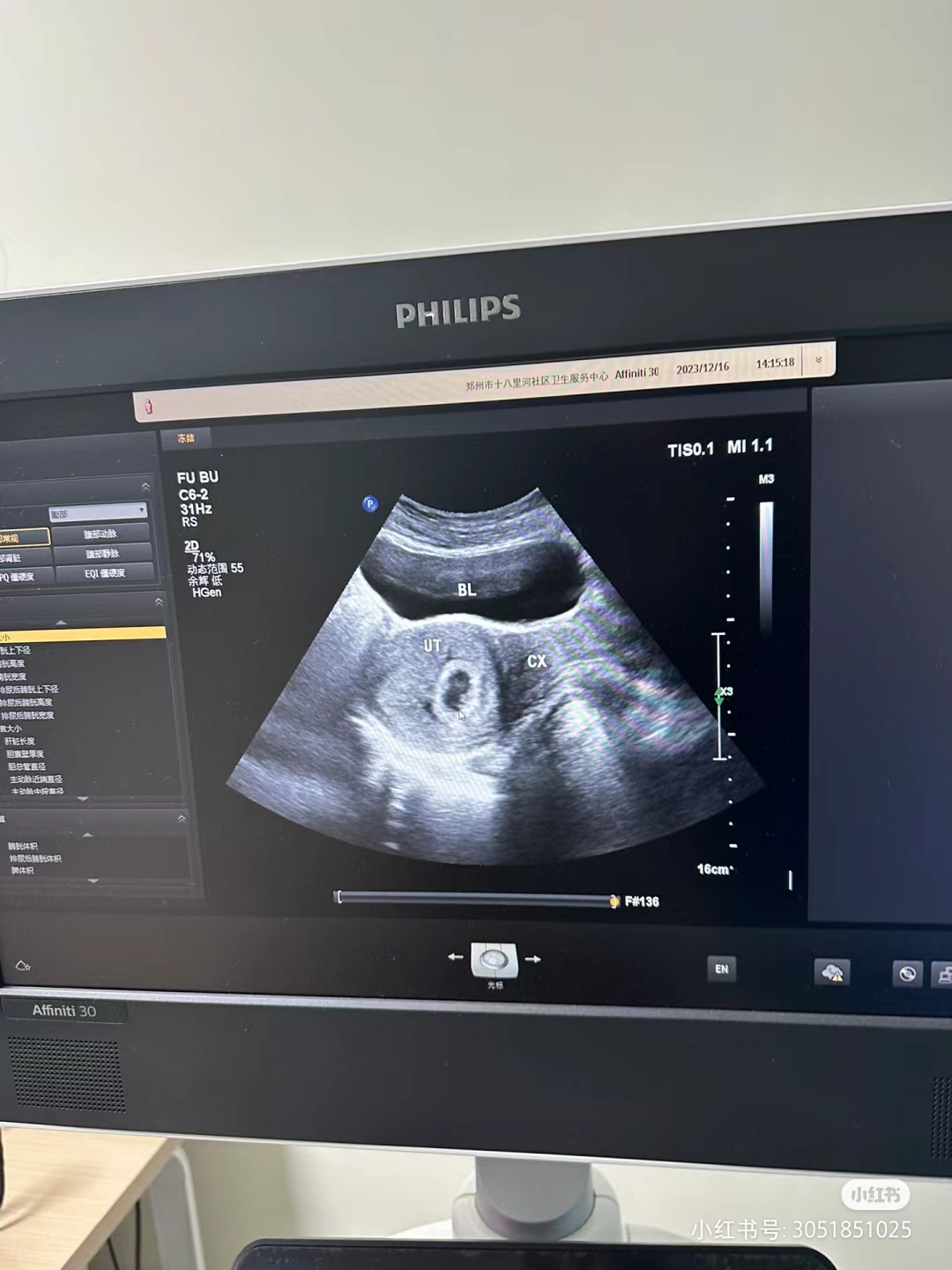 每天靠外卖度日,老公忙于挣钱,顾不上我