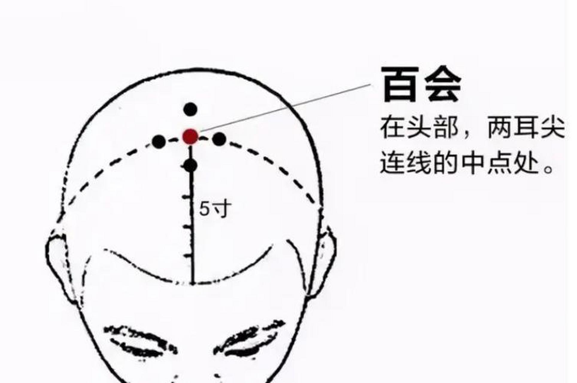 关元的准确位置图图解图片