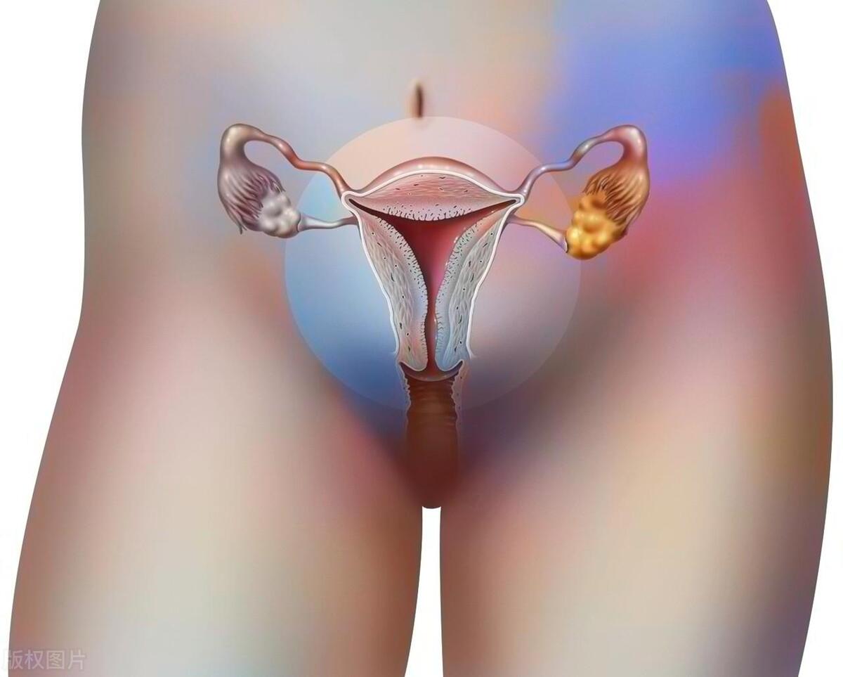 子宫光滑的女人,身上没有4个症状.若你都没有,那子宫真不错!