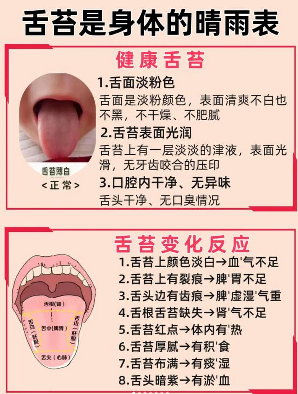 其实健康的舌苔,应该是:舌面呈淡粉色,舌苔表面光润,不干燥,也不湿滑