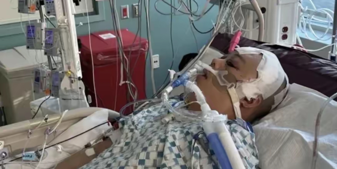 子弹从脑袋进入,从左眼穿出,这位美国籍的前国人因此受了重伤.