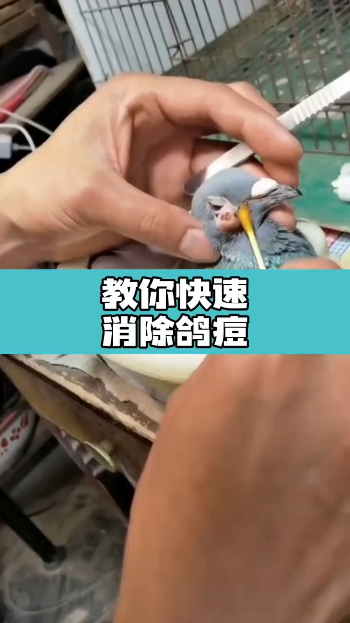 鸽痘频发教你快速消除疙瘩