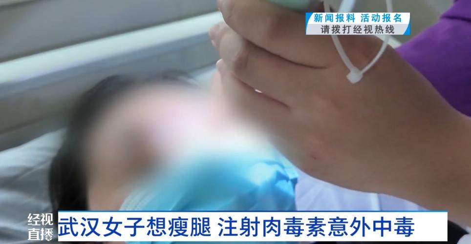 我打了5次肉毒素瘦腿图片