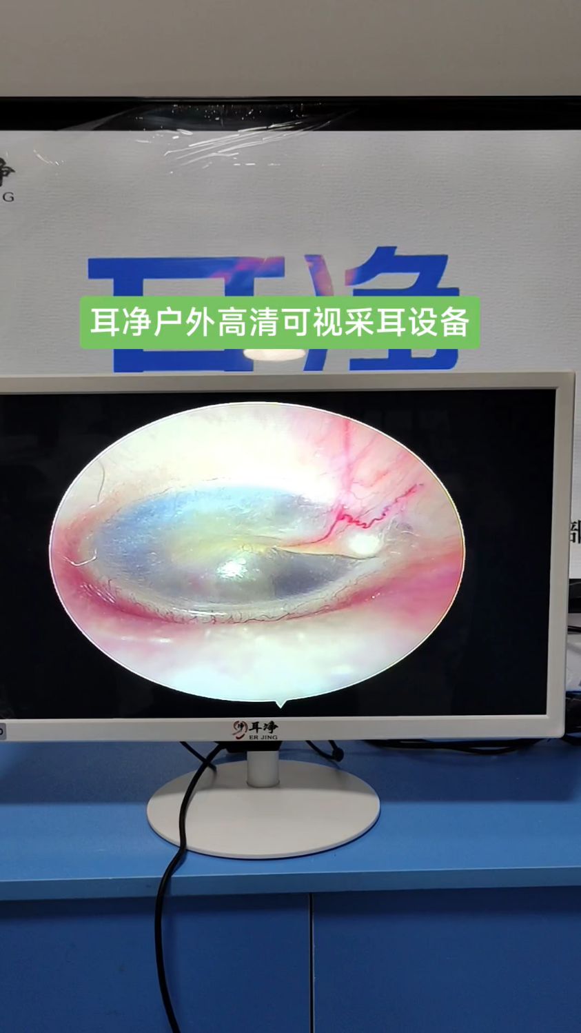 可视采耳仪器采耳机器掏耳神器