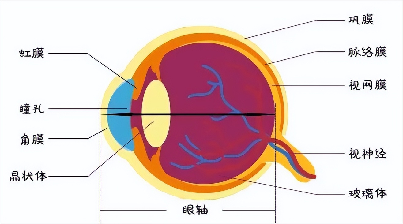 20岁脉络膜新生血管图片