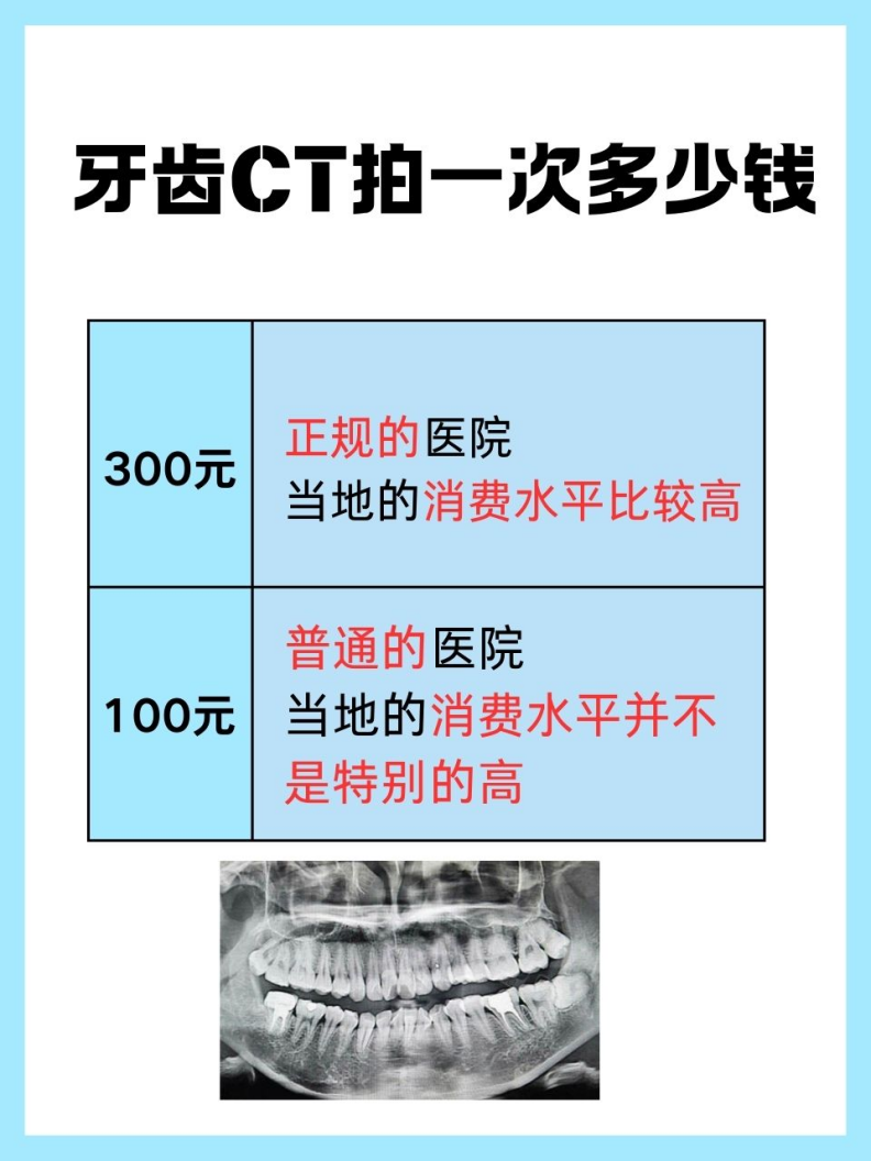 牙齿拍片多少钱图片