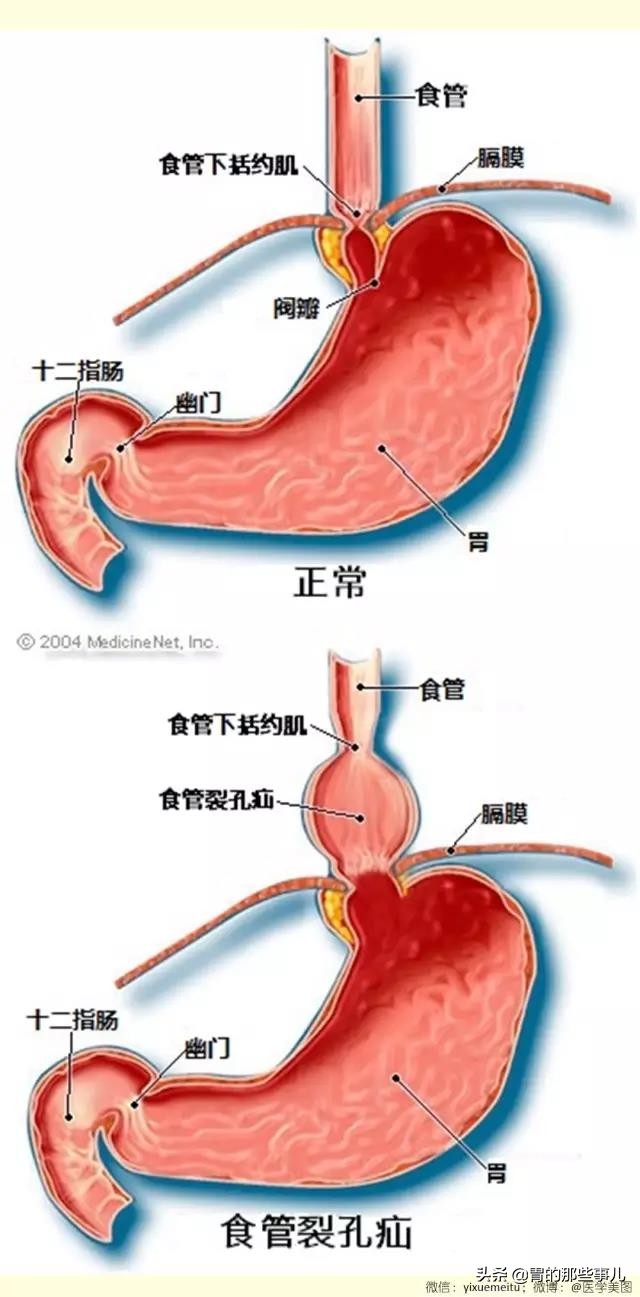 食道位置图片图片