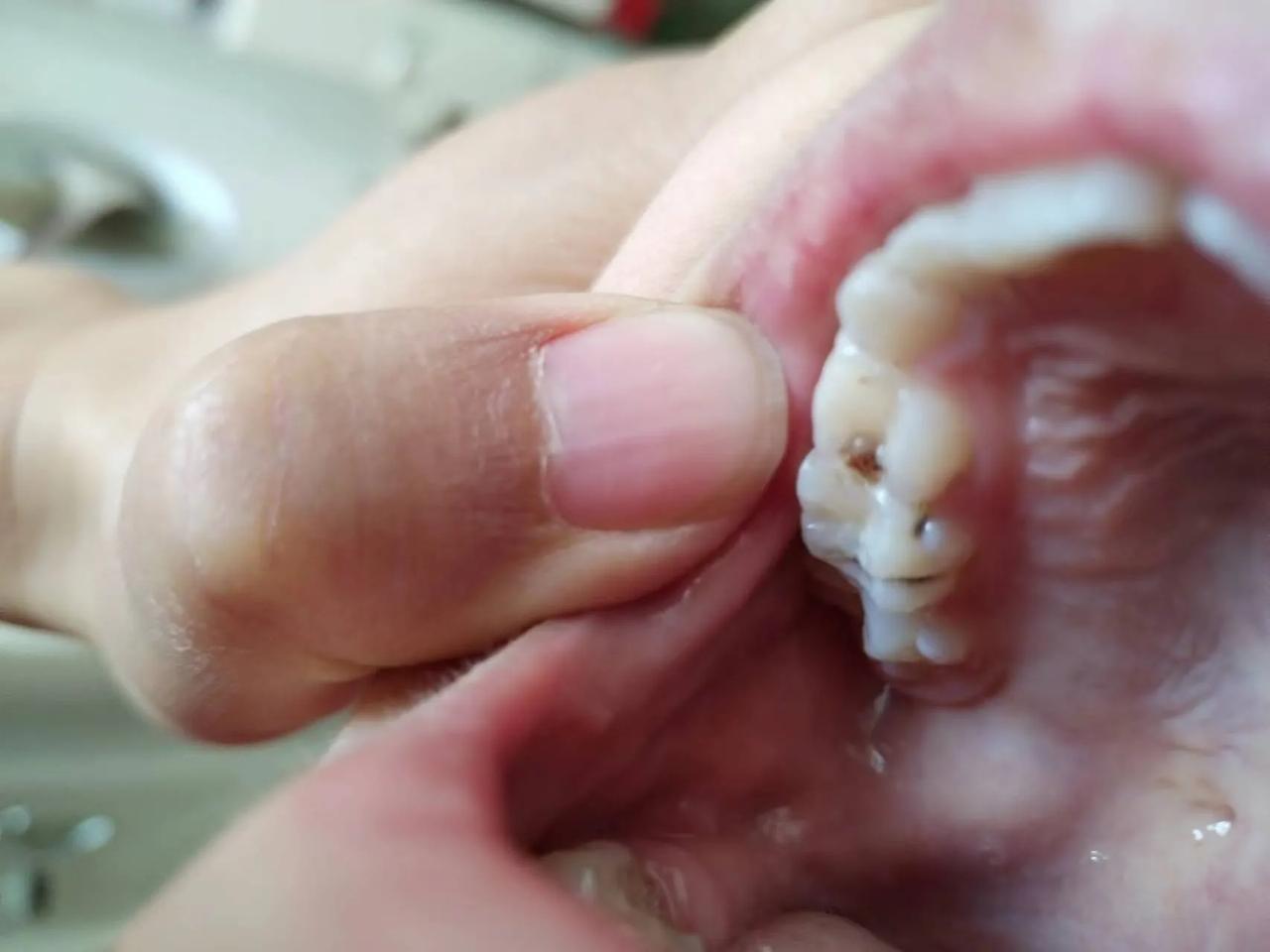 牙齿这样了,还有的救吗?