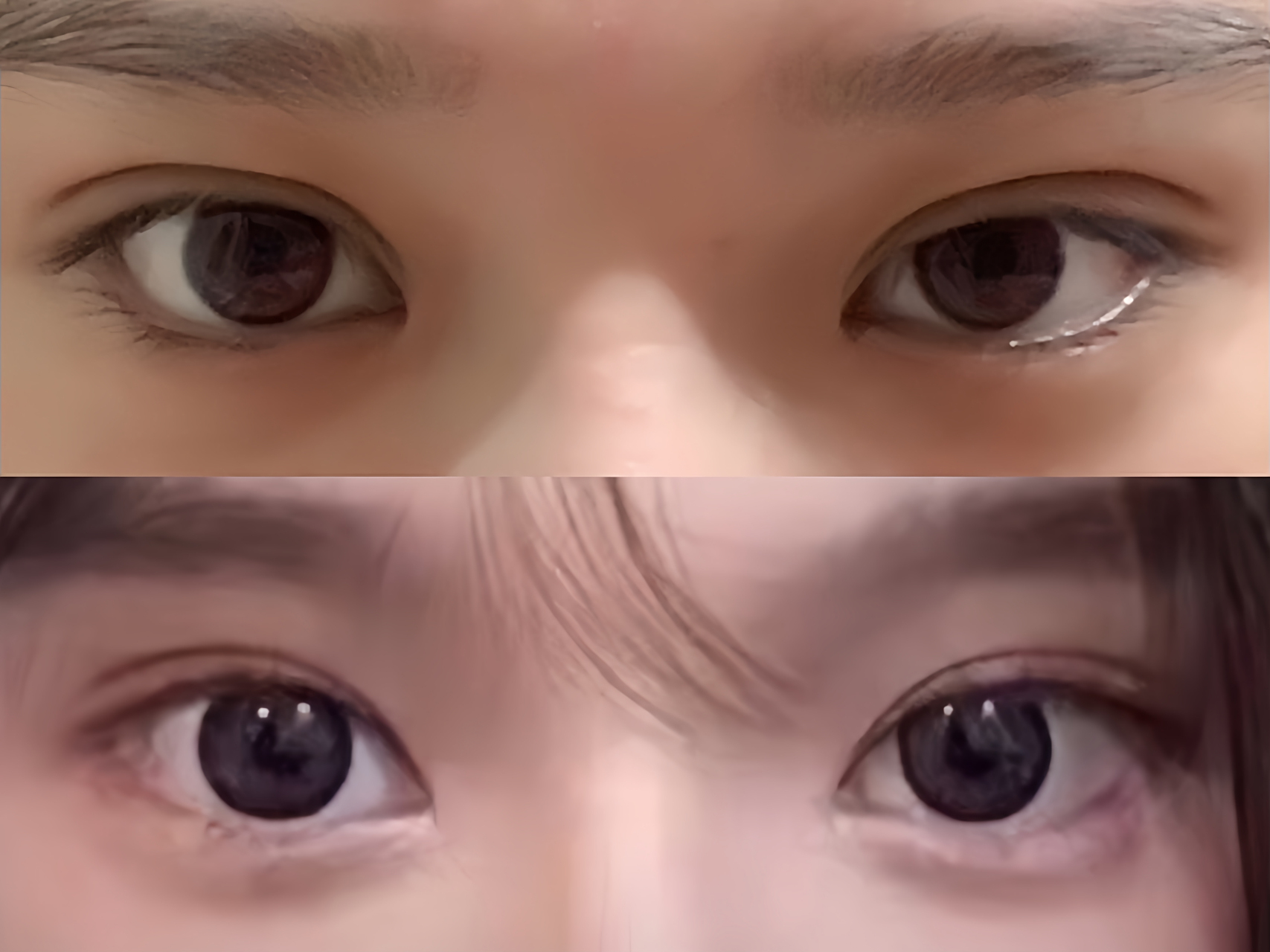 好喜欢!#双眼皮