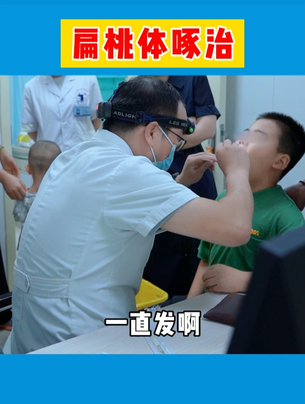 儿童扁桃体啄治法