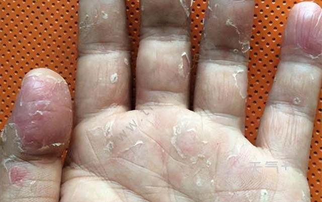 洗洁精是"害人精"?清水冲不干净?过来人说几句大实话!