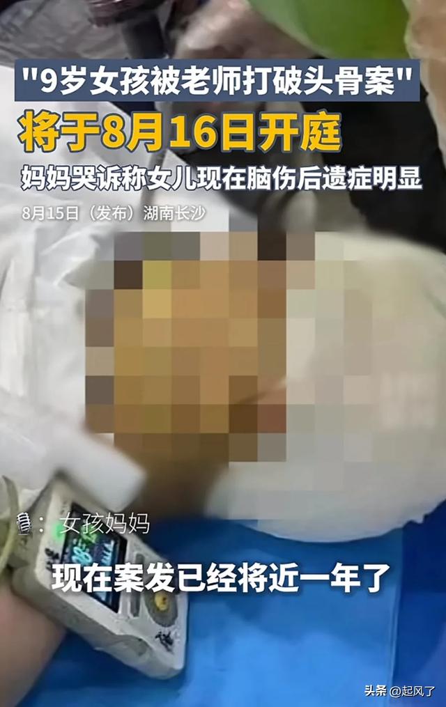 女孩被老师打破头骨脑浆流出,学校称监控没调试,老师不认罪认罚
