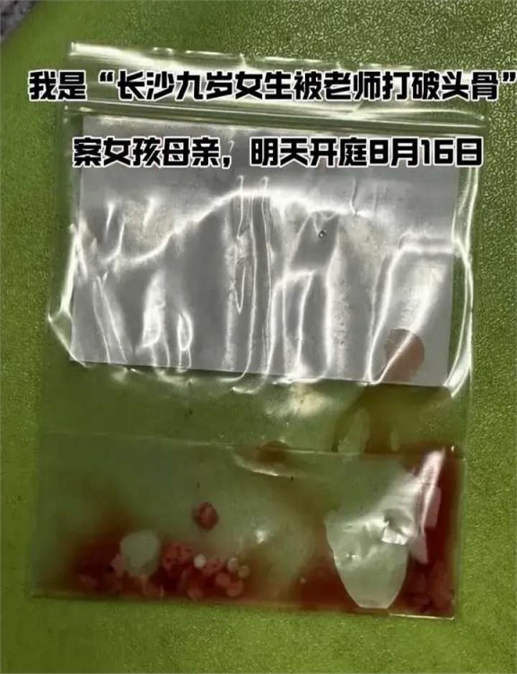 长沙9岁女孩被老师打碎头骨脑浆流出!孩子醒来之后发声了!