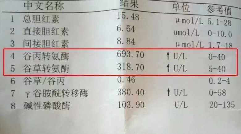 三,顽固性腹胀 四,合并感染 五,肝性脑病#肝性脑病# #谷氨酰转肽酶
