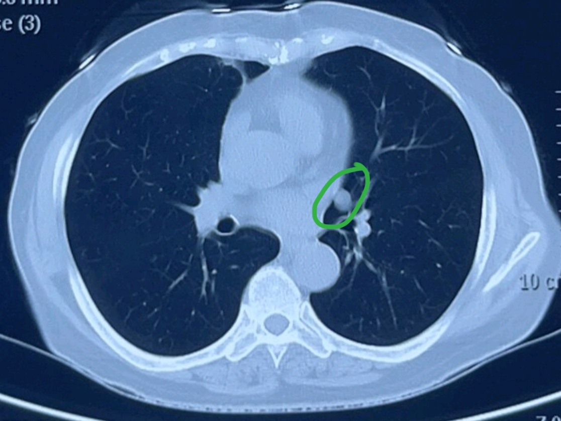 民航总医院预约挂号CT加急-民航总医院预约挂号ct加急多少钱 