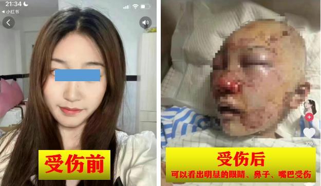 伤势鉴定仅仅为轻伤二级以上?