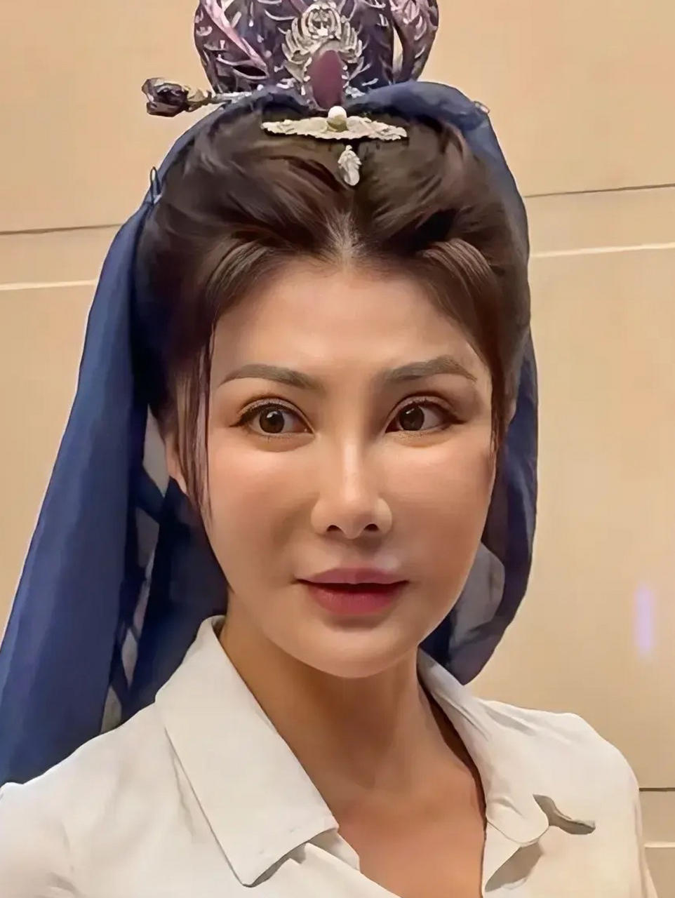 53岁的武打女星杨丽菁,这张脸整容给整垮了,脸部僵硬的没法看,肉毒