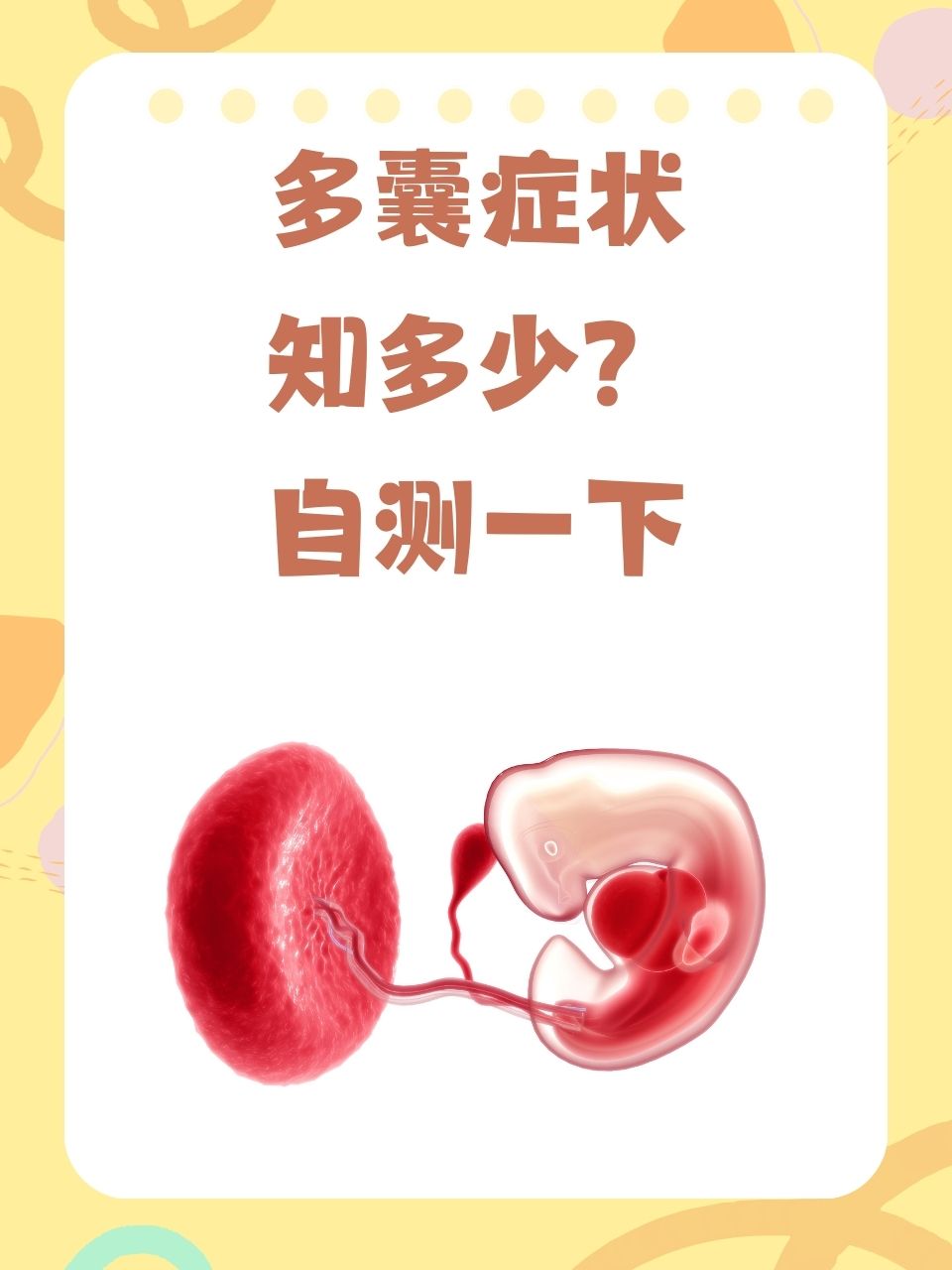 卵巢多囊的症状表现有哪些(卵巢多囊症是怎么形成的,需要怎么治疗)