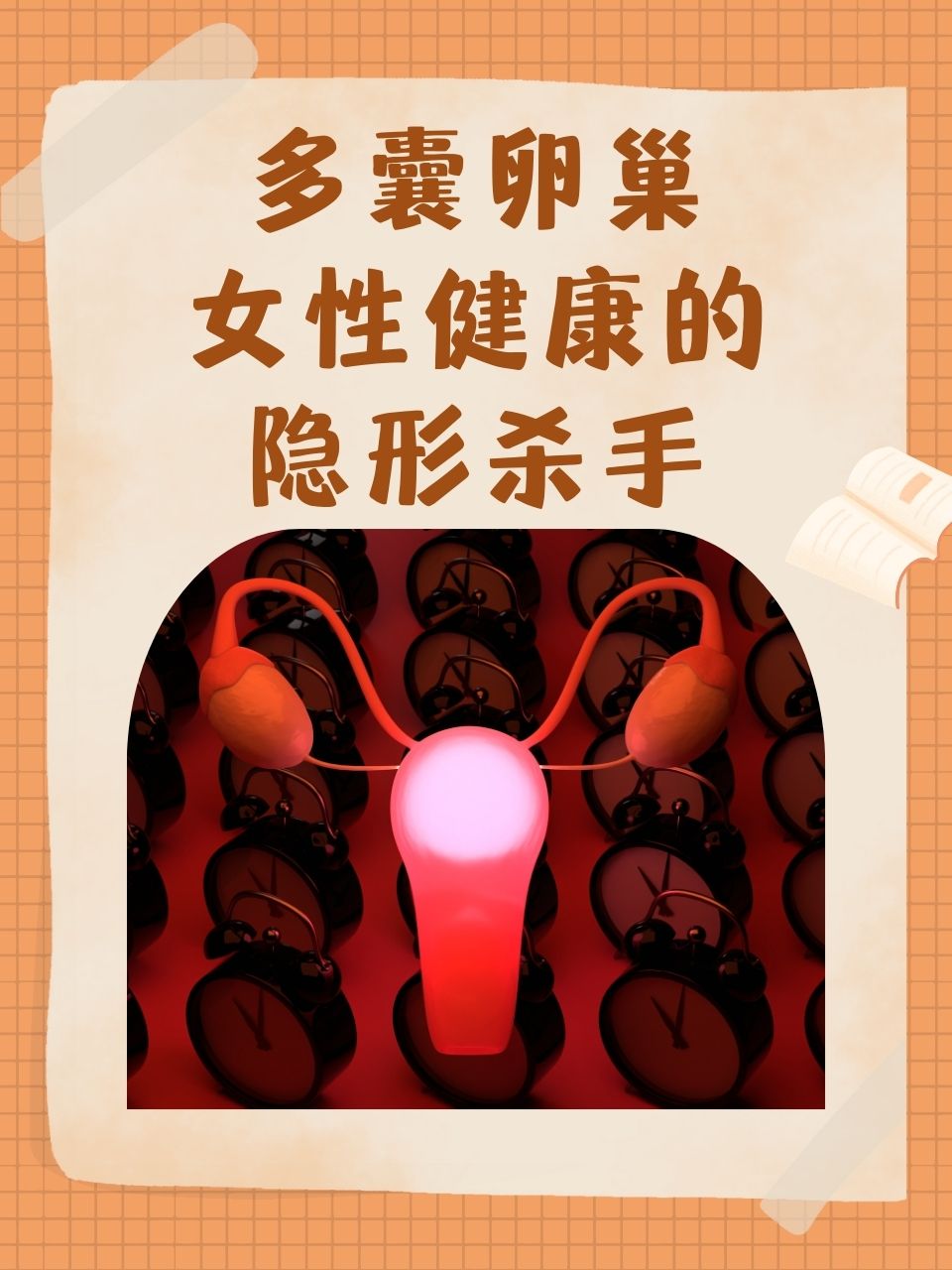 多囊性卵巢能治疗吗_多囊卵巢可以治疗好吗?  第2张