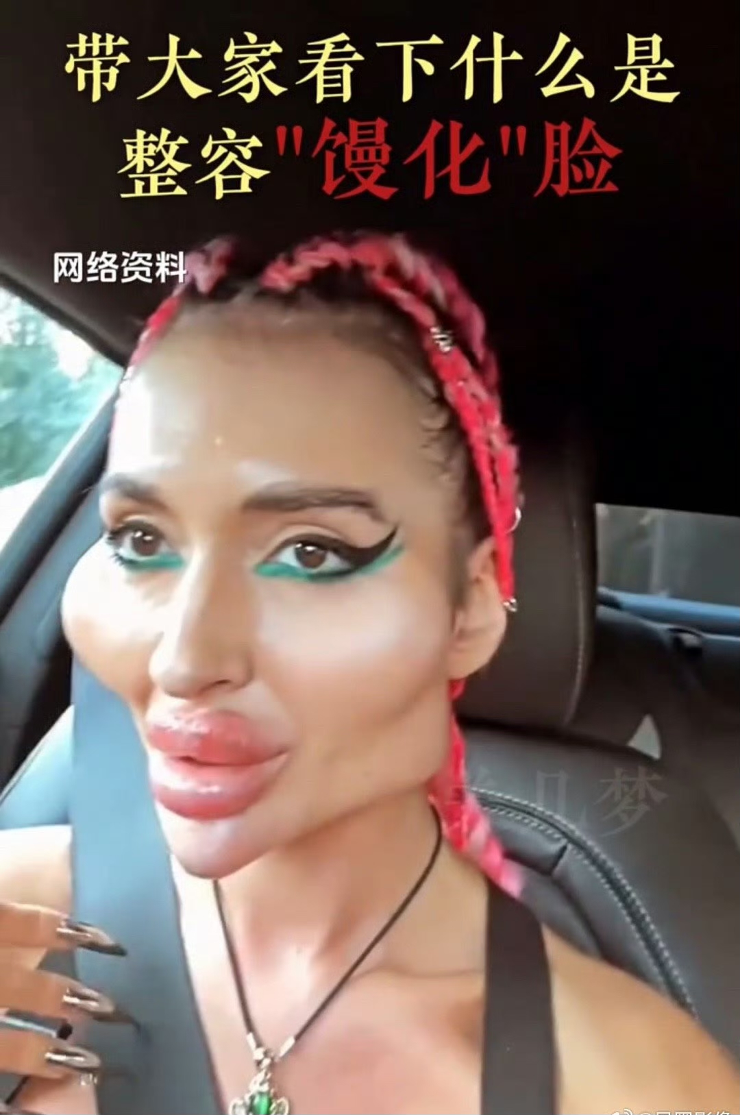 乌克兰的一个网红,整容真的只有一次和无数次. 整容的审美很重要!