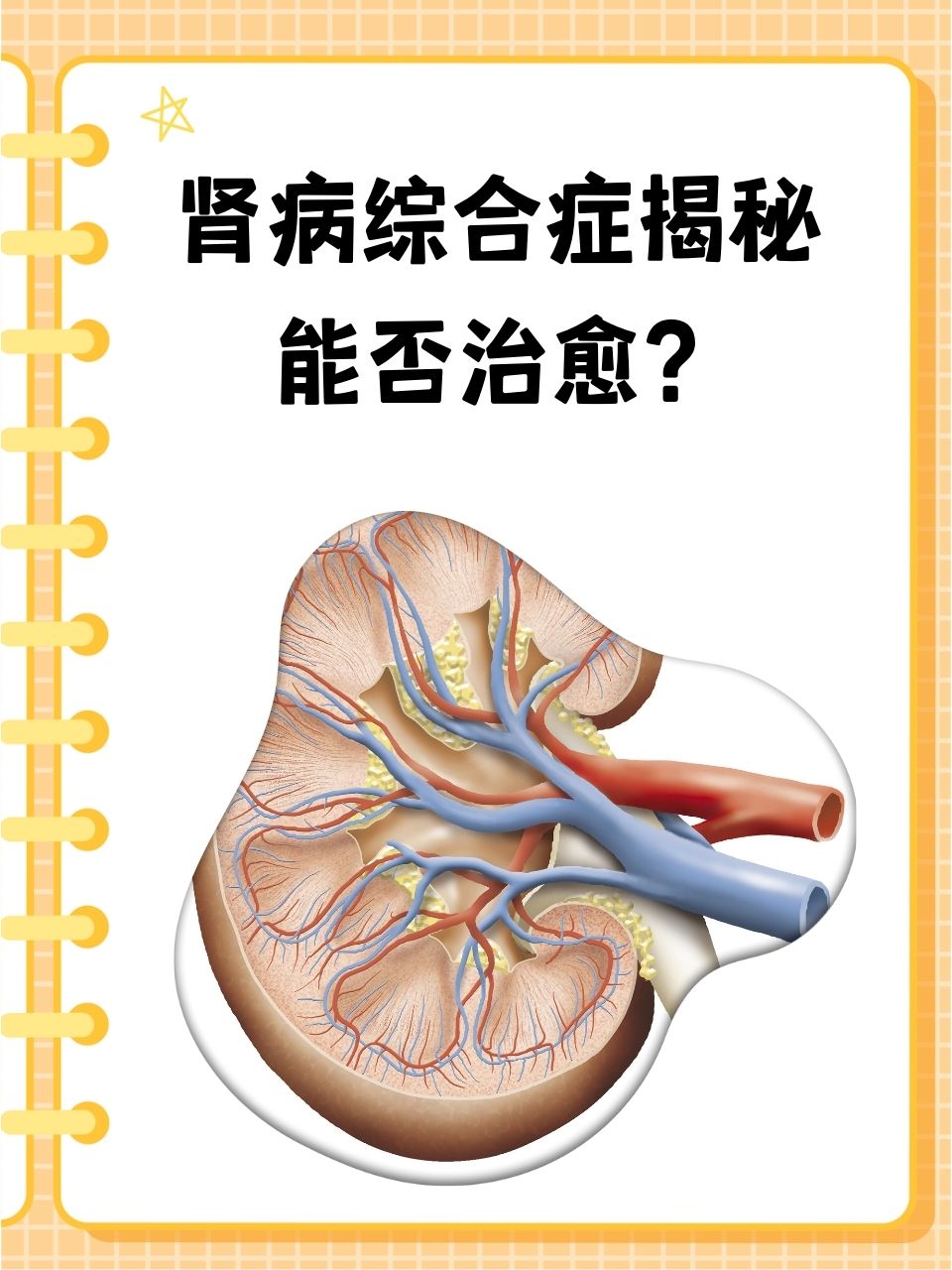 肾病综合症揭秘:能否治愈?