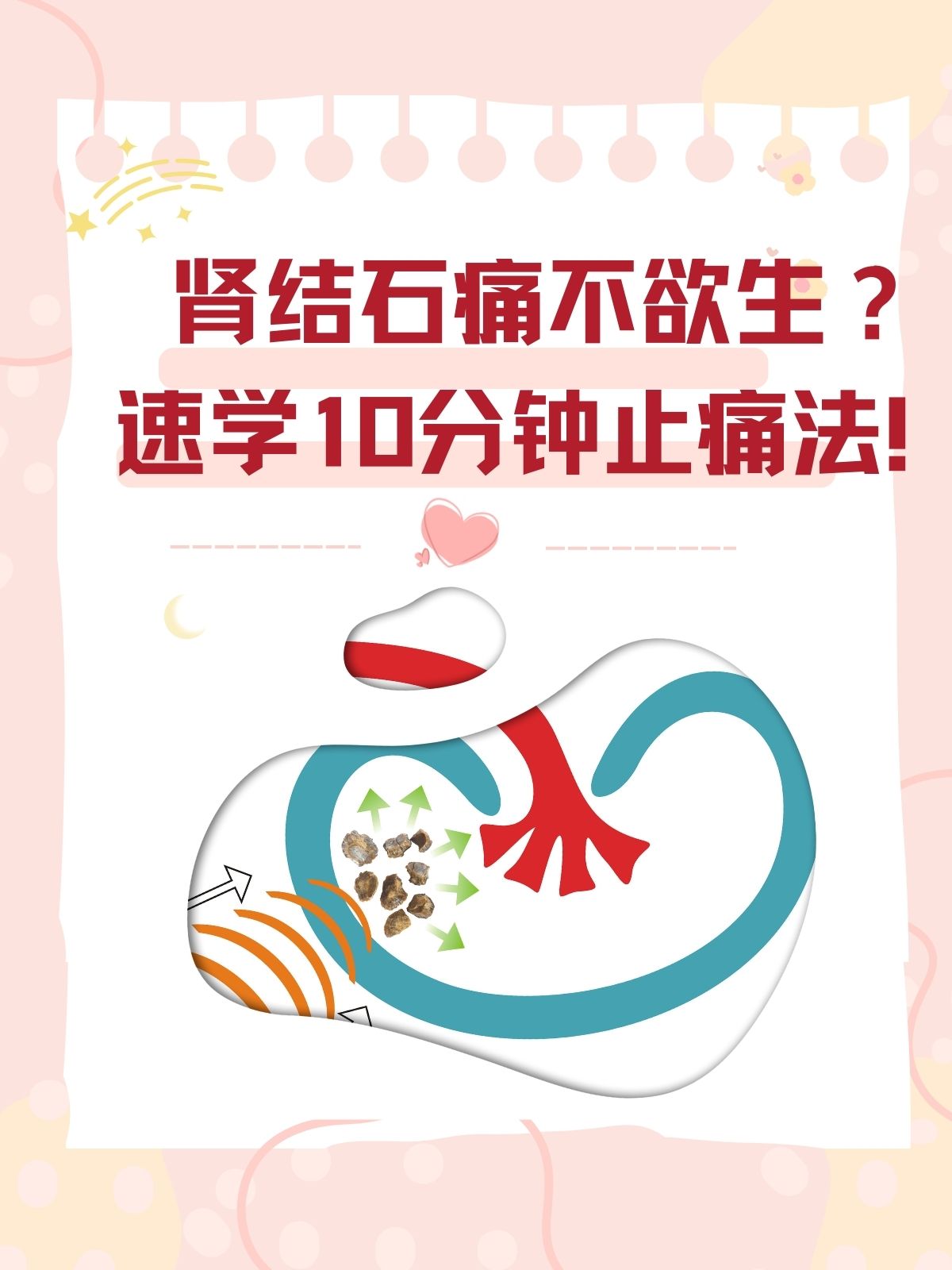 肾结石的发病率逐渐升高,给患者带来了极大的痛苦