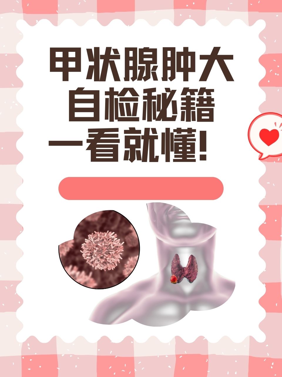 甲状腺自检方法图片