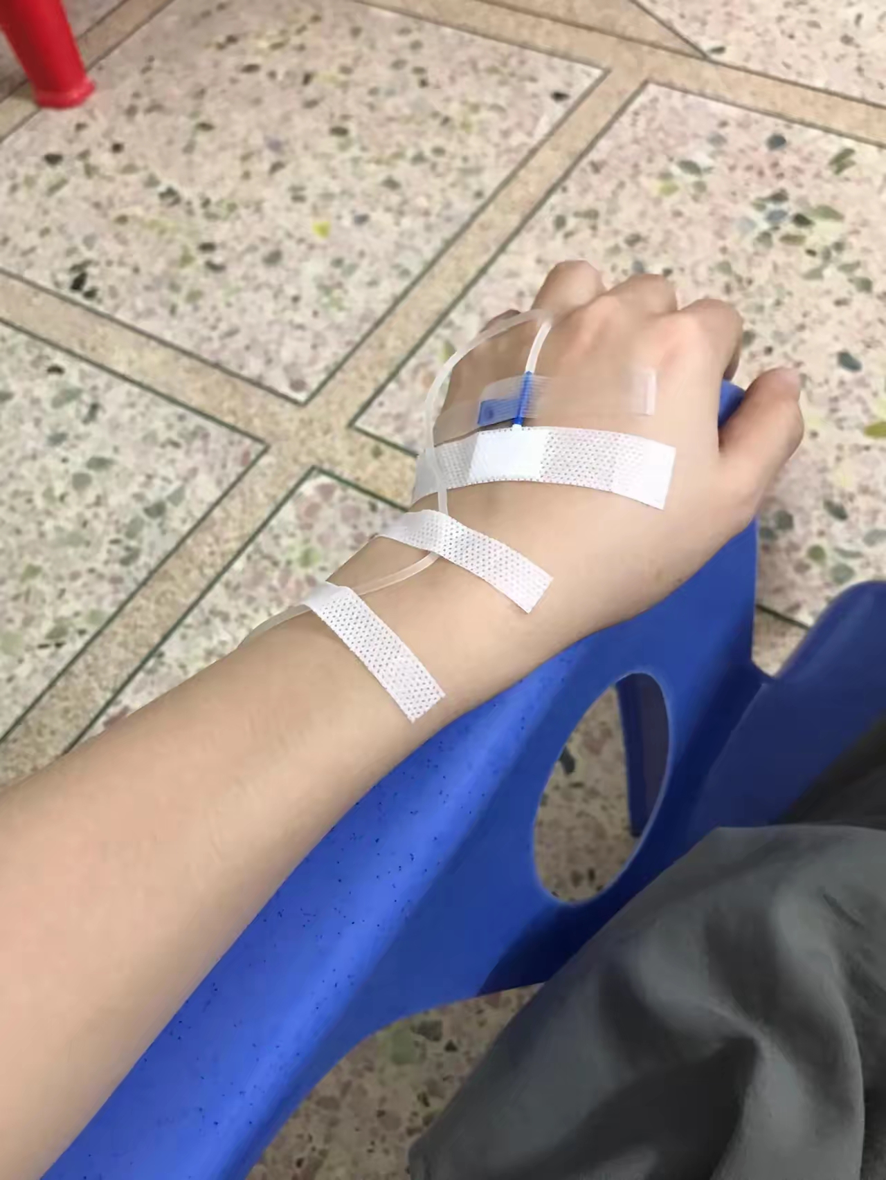 "昨天,我胃炎犯了,去诊所输液