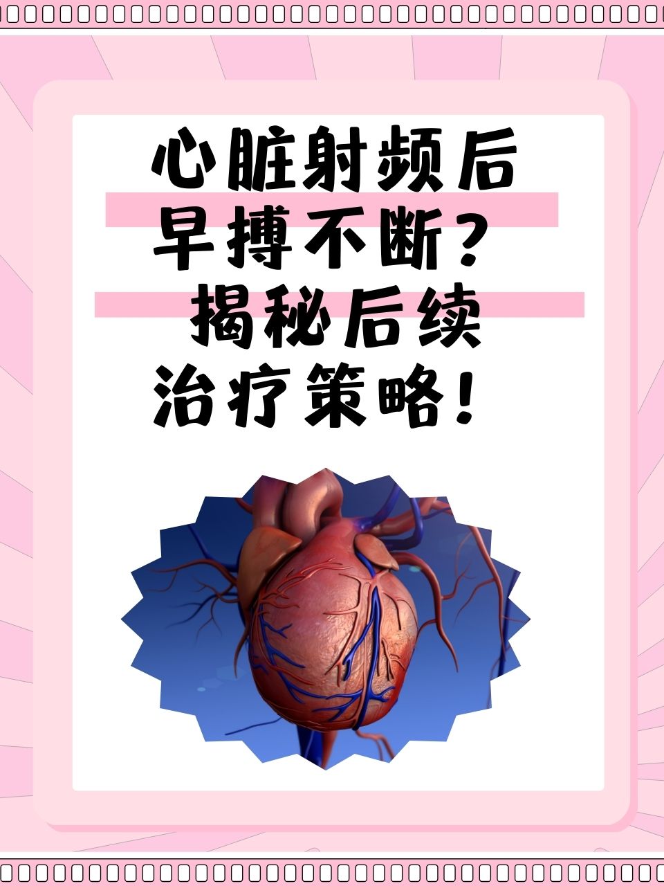 有些患者在经历了心脏射频消融术后,却依然面临频繁室性早搏的困扰