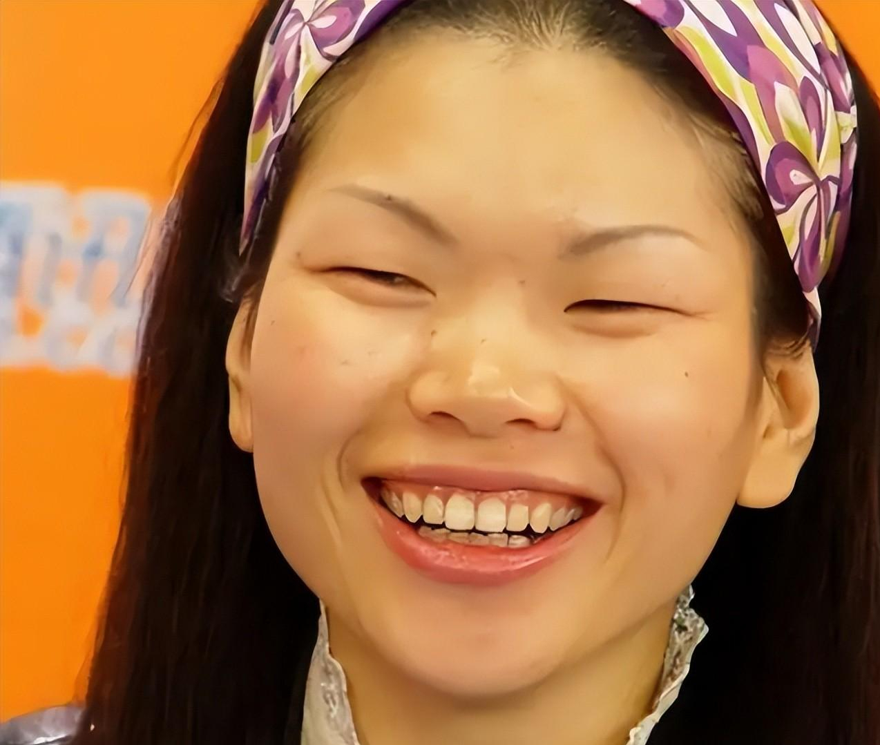 纤细的身材,妥妥的"女巨人"一枚,再加上单眼皮,眯眯眼,塌鼻梁,还有点