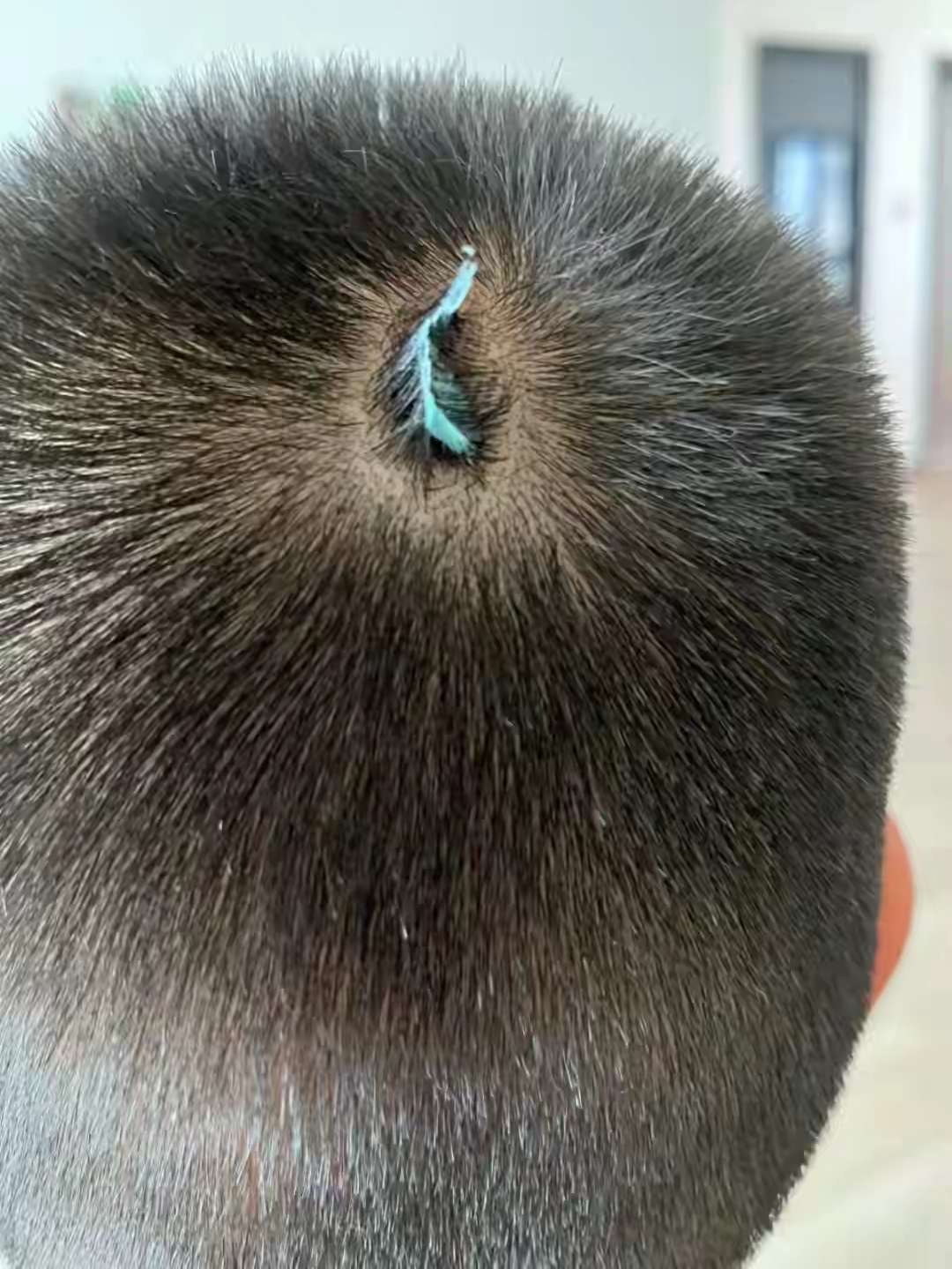 孩子在外面玩不知道那个捣蛋鬼弄的准备开学了不想剃掉头发要怎么