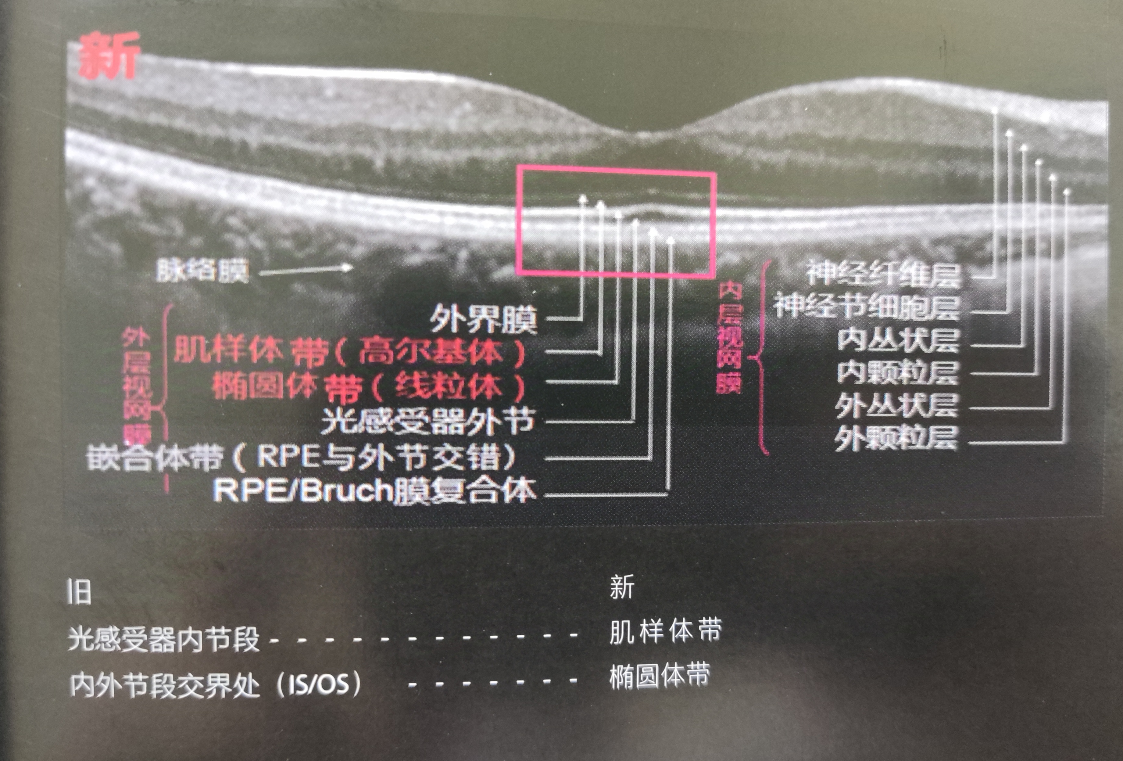 视神经颅内段图片