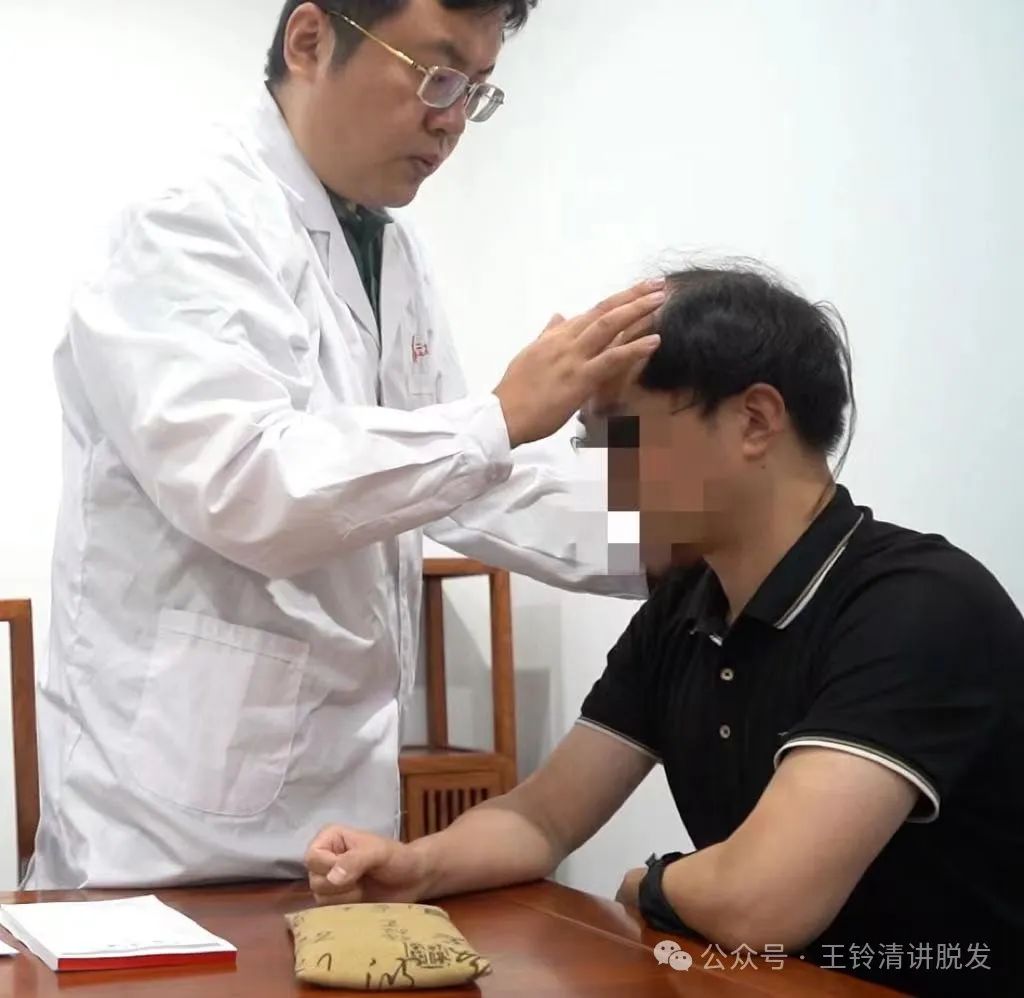 行医多年,我常这样思考:为什么很多脱发患者宁愿天天吃药片,也不愿意