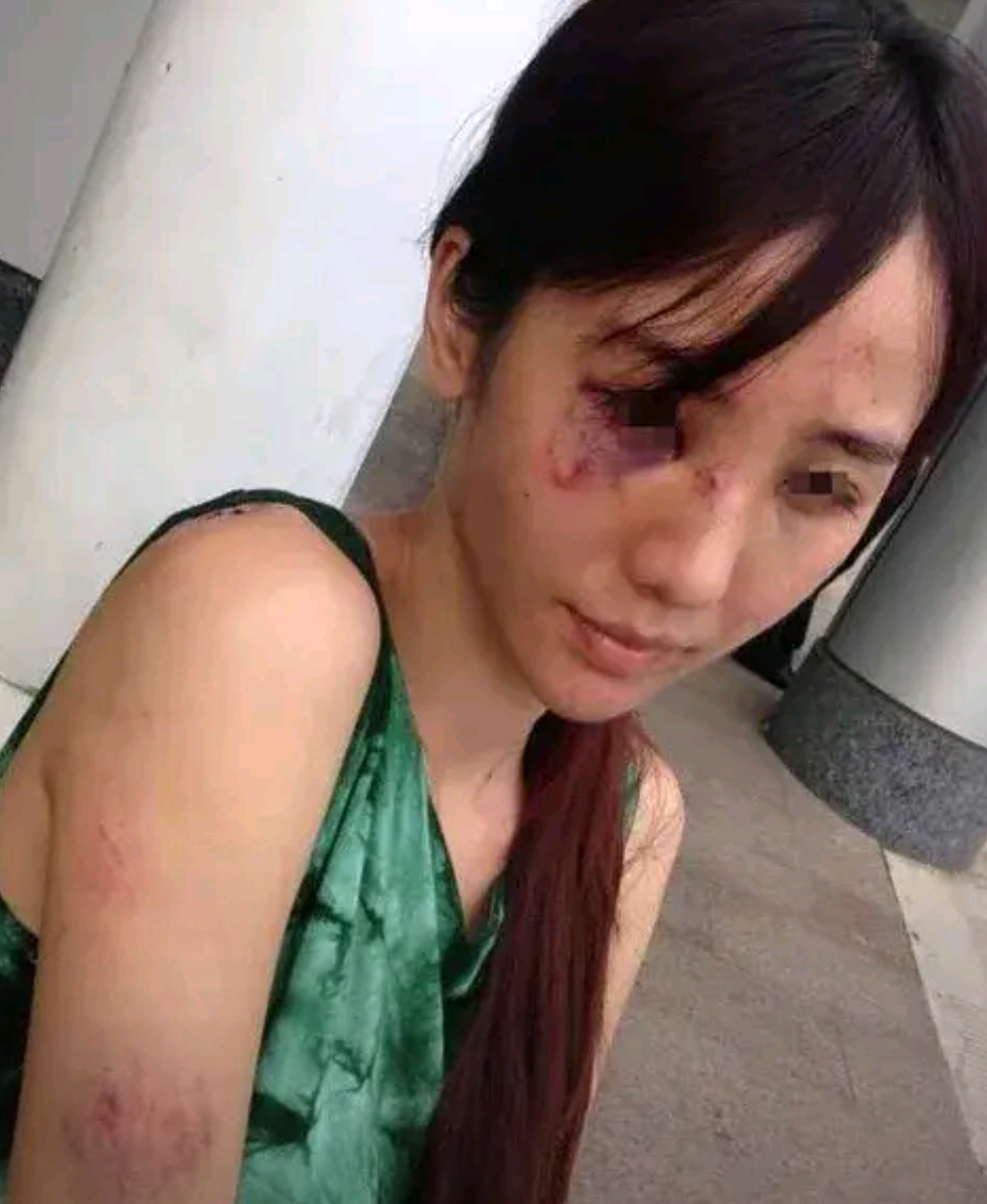 照勒索事件照片家暴案例真实图片醉酒家暴美女被人"这就是家暴的下场!
