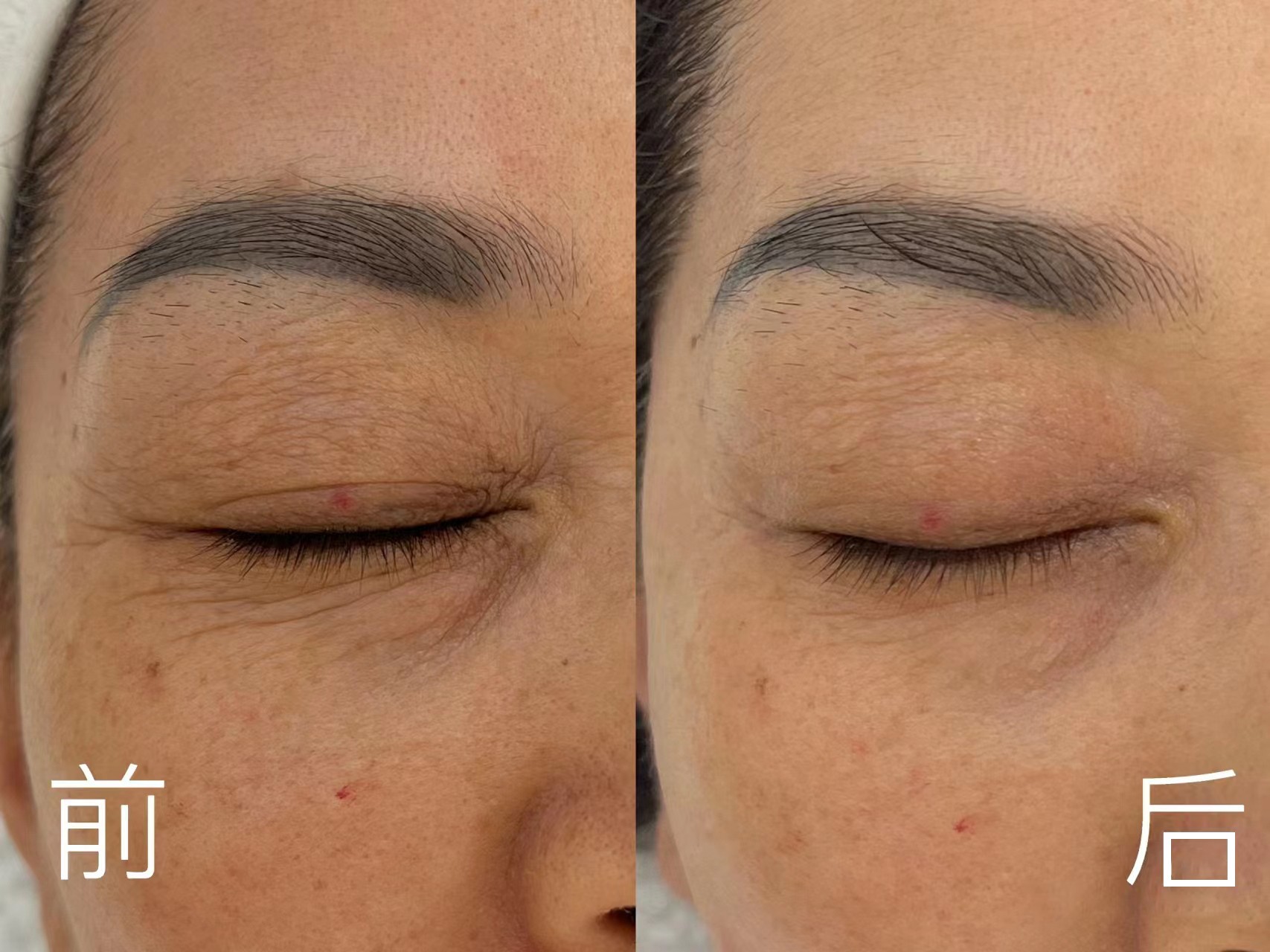 什么眼霜去皱效果好?这四款高性价比眼霜不容错过