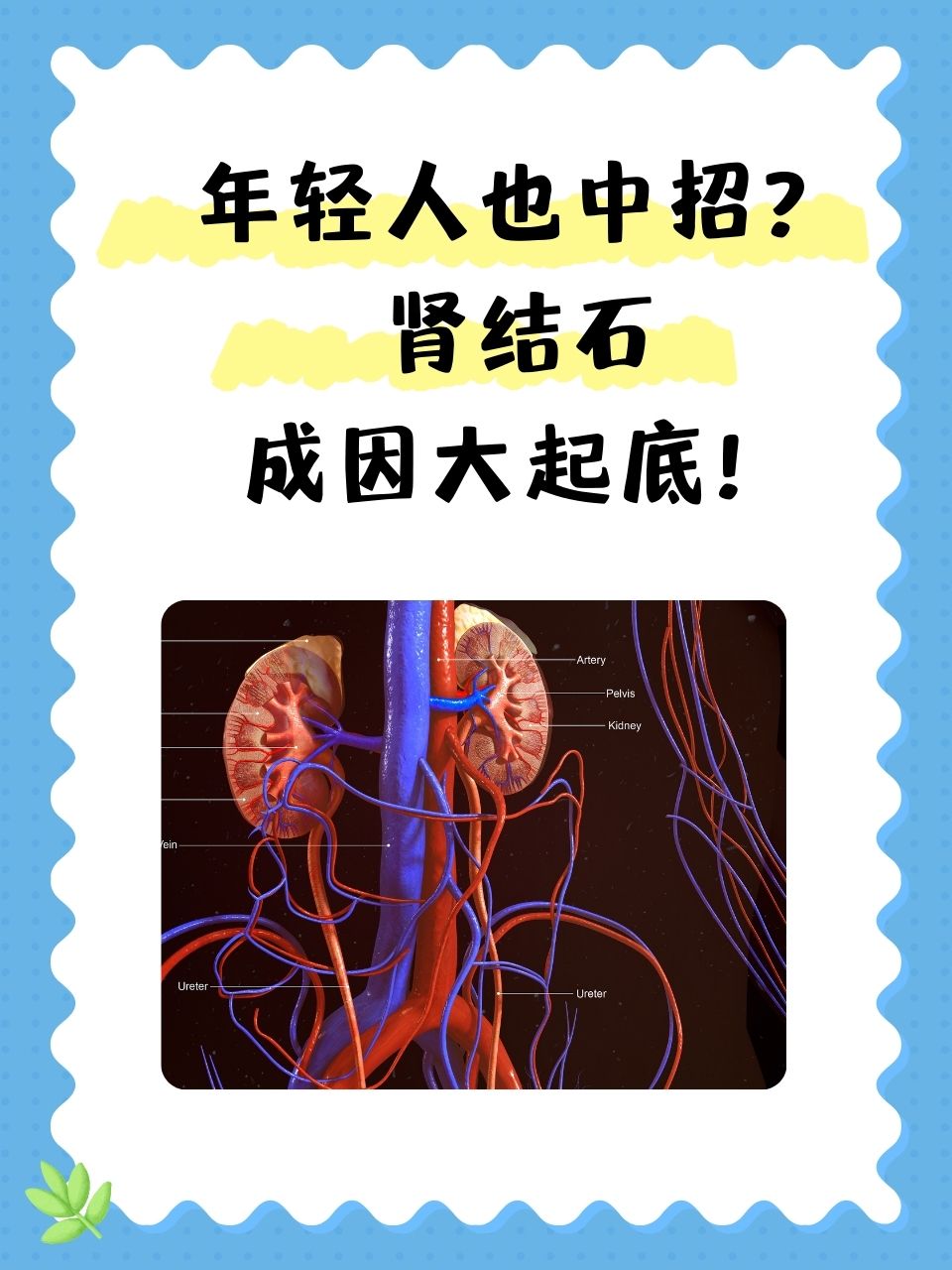 为什么得肾结石