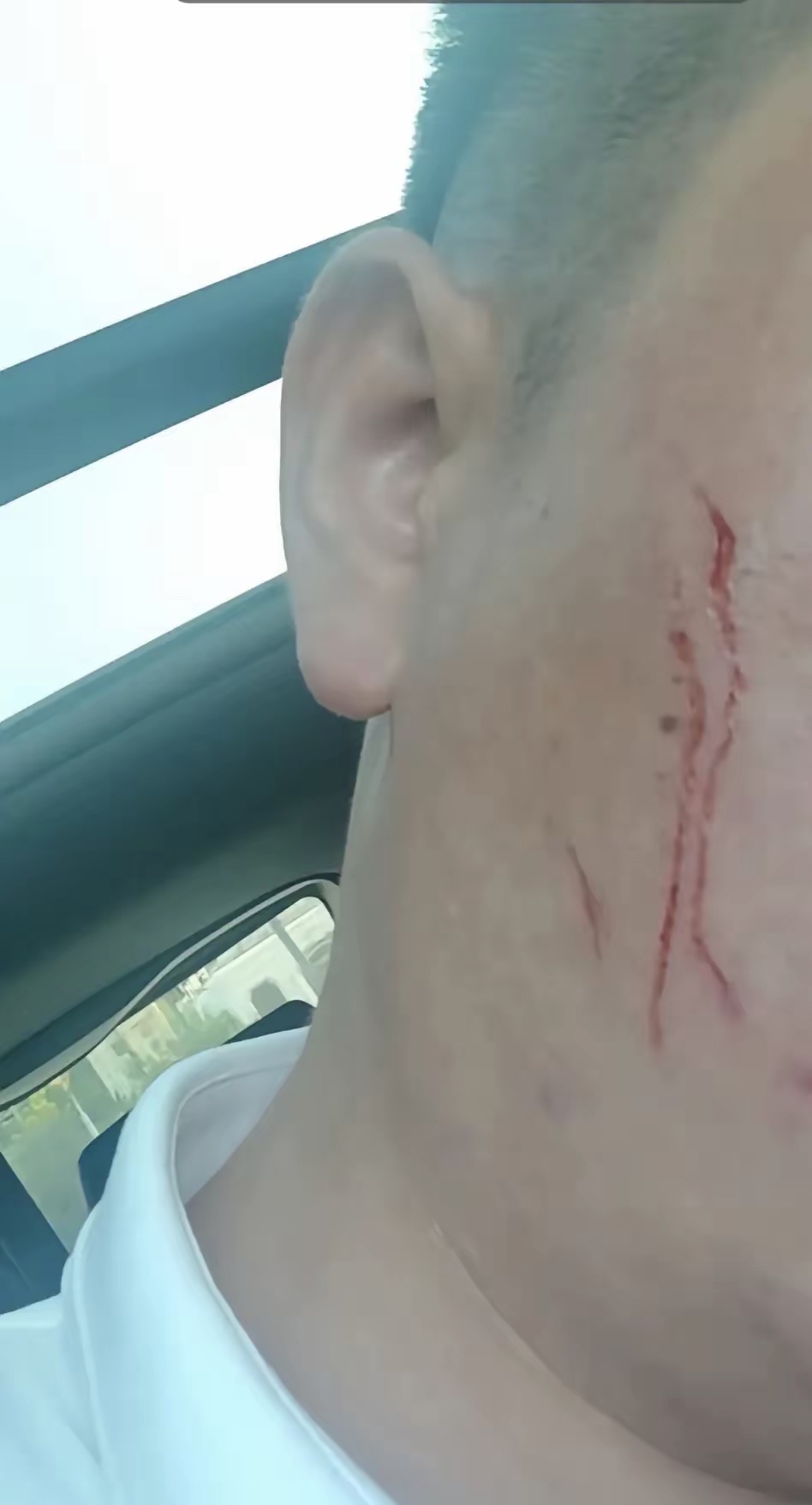 在这里奉劝大家,以后亲兄弟的家事也不要去管,打死