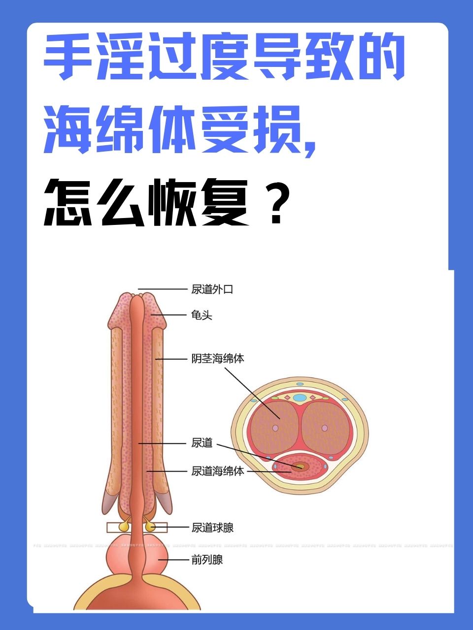 手淫过度导致的海绵体受损