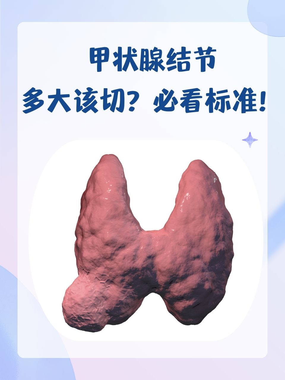 甲状腺结节会消失吗图片