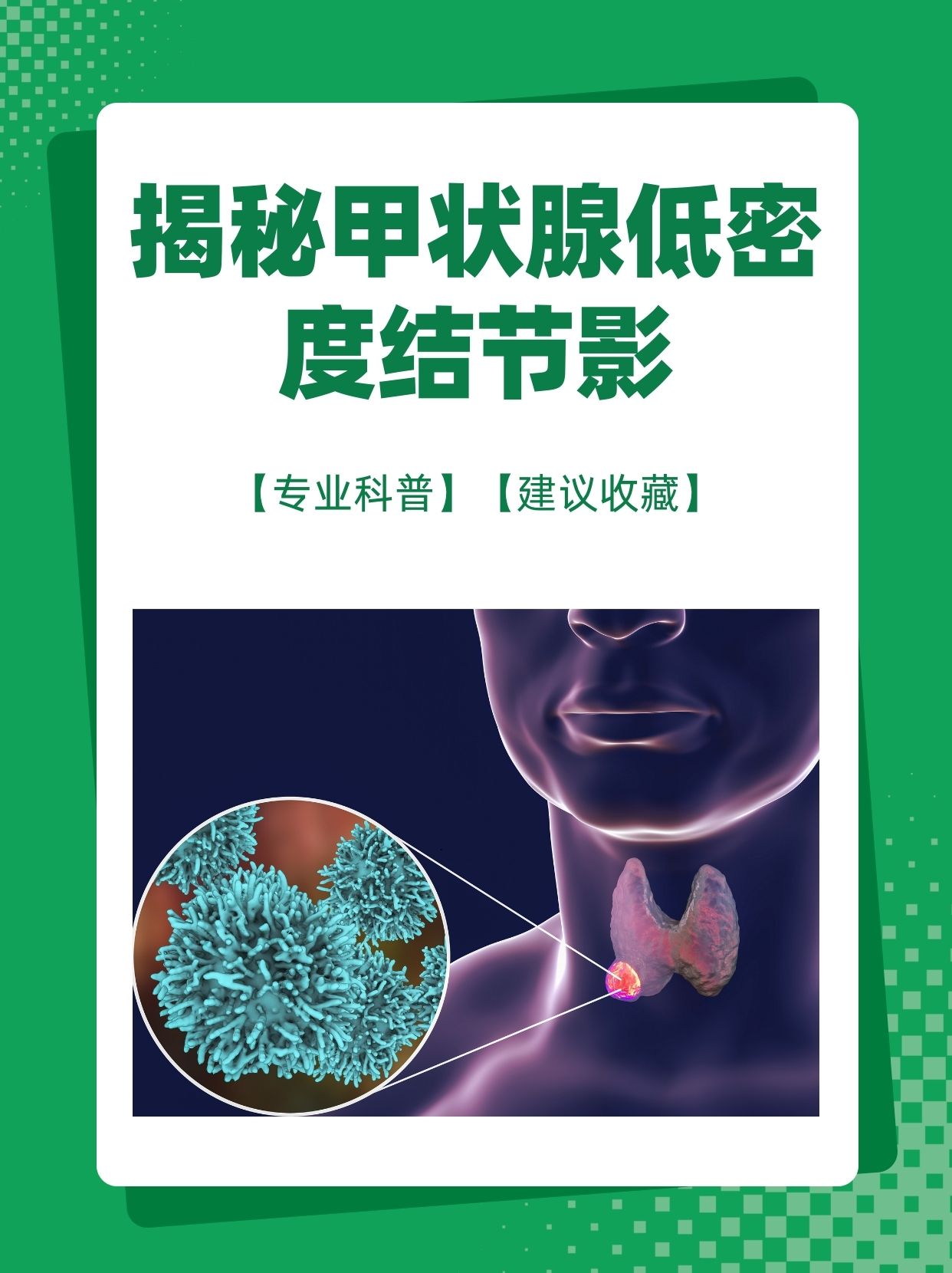 甲状腺结节彗星尾图片